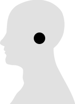 ear conditions