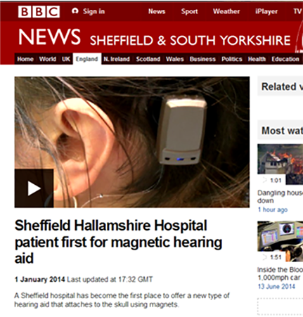 magnetic hearing aid