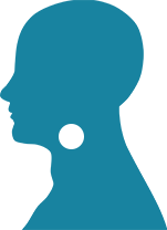 throat conditions